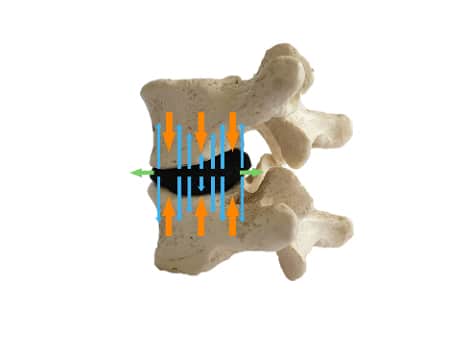 Intervertebral disc structure